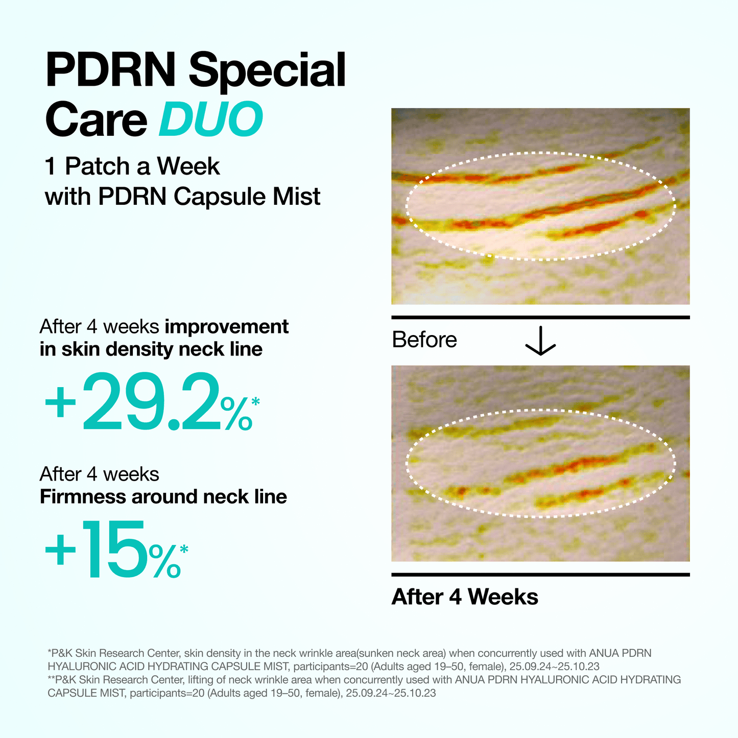 PDRN Collagen Wrinkle Intensive Smoothing Set for Neck